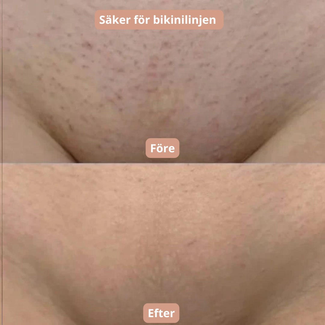 Pureshave - Glöm röda prickar och irriterande hud!