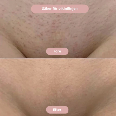 Pureshave Ultra - Glöm röda prickar och irriterande hud!