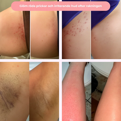 Pureshave Magic - Glöm irriterande röda prickar!